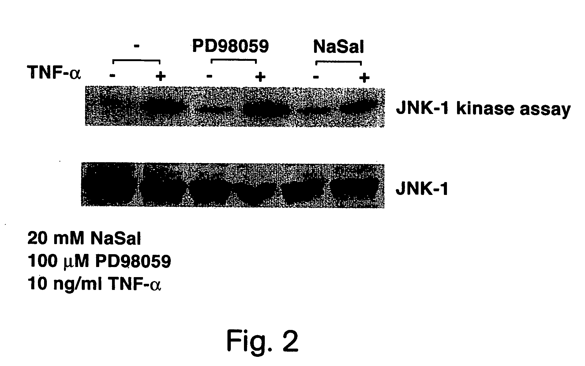 Methods for treating and preventing insulin resistance and related disorders