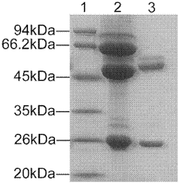 Antigen epitope for preventing and treating trichinosis, composition thereof and application thereof