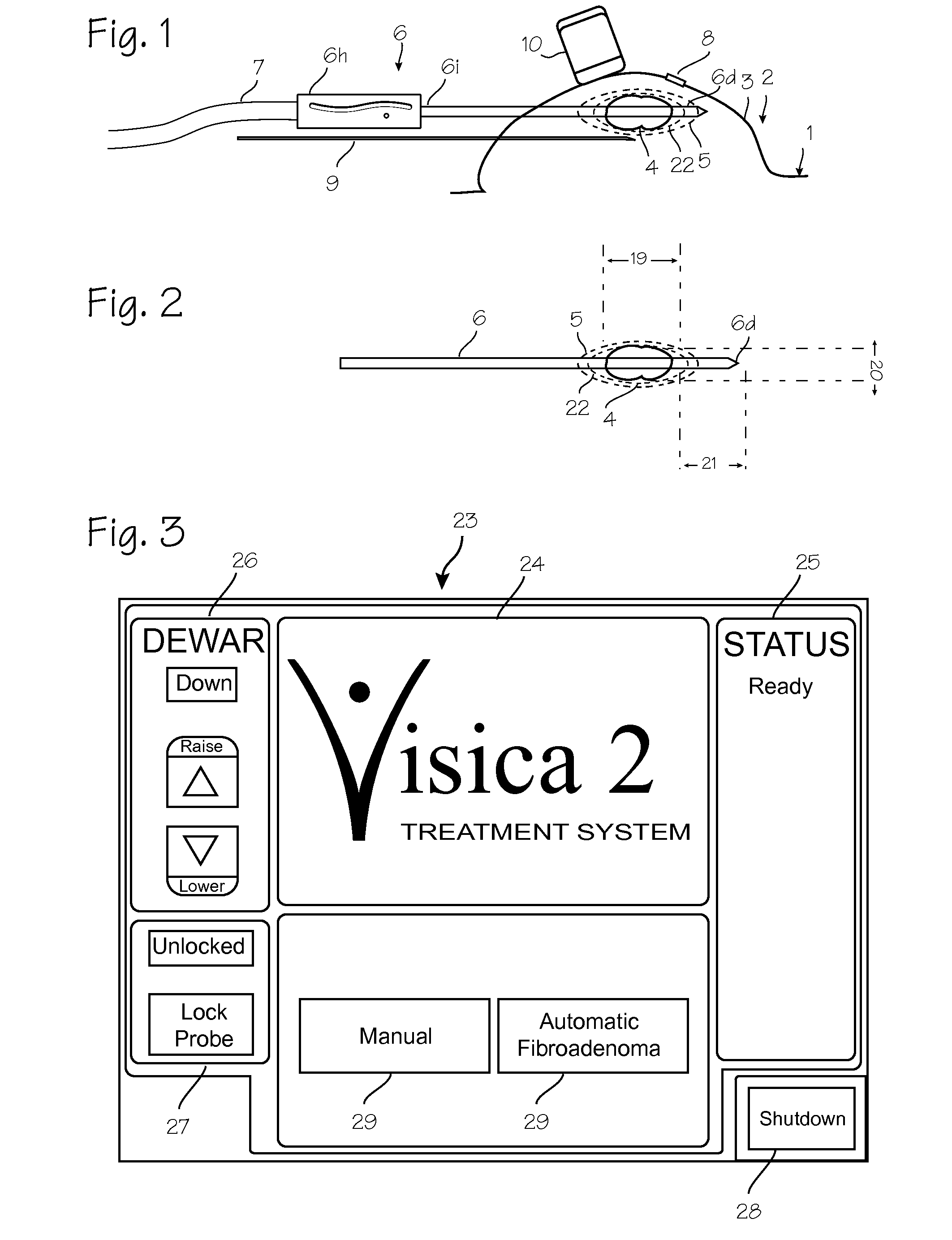 Cryosurgical System with Low Pressure Cryogenic Fluid Supply