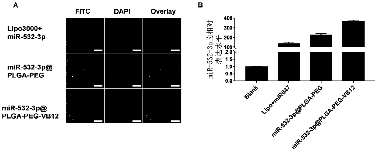 Synthesis method and application of miRNA-carrying VB12 binding type nano-composite