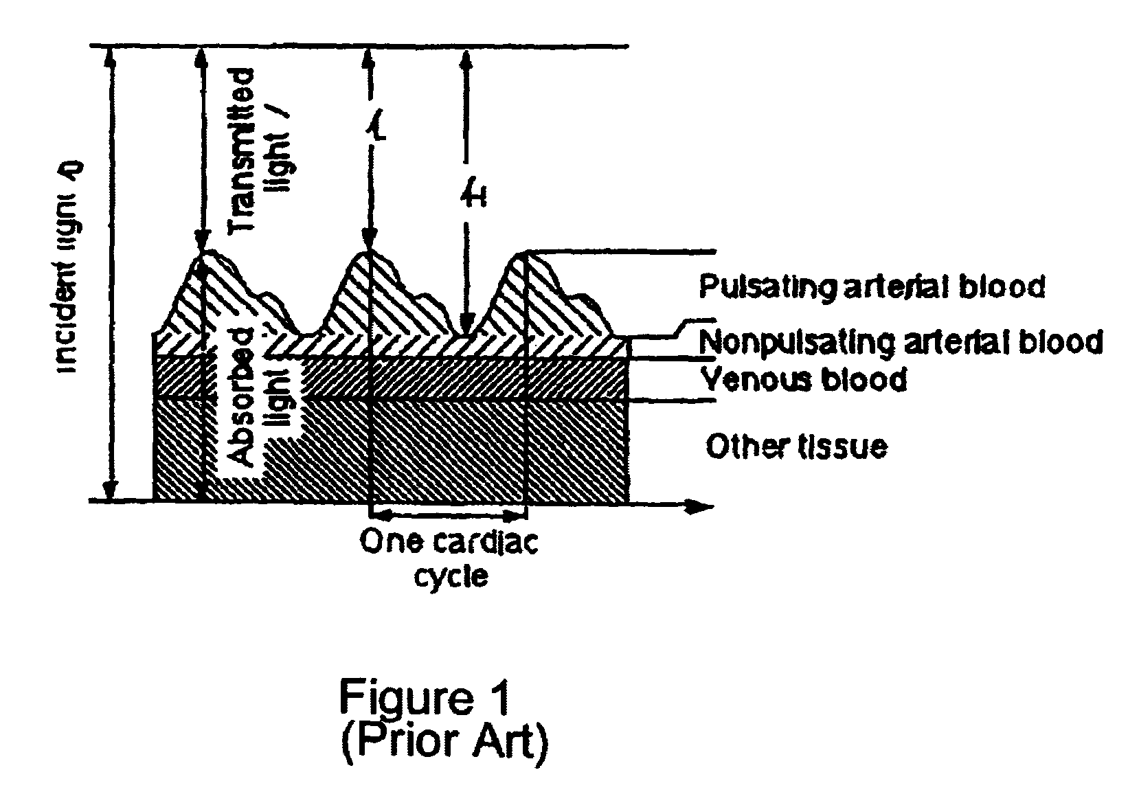 Method and apparatus for noninvasive physiologic monitoring