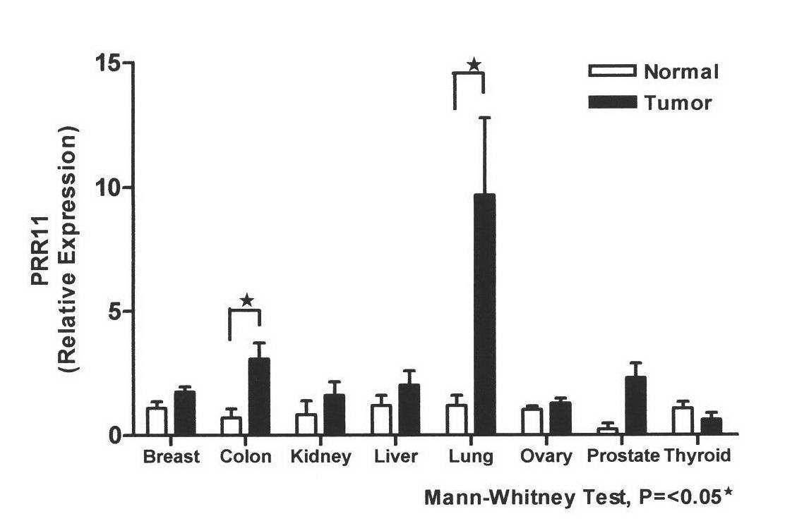 PRR11 gene and coded protein and application thereof