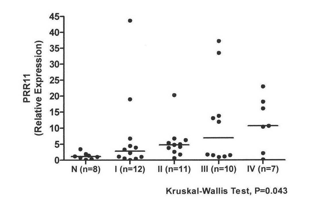 PRR11 gene and coded protein and application thereof