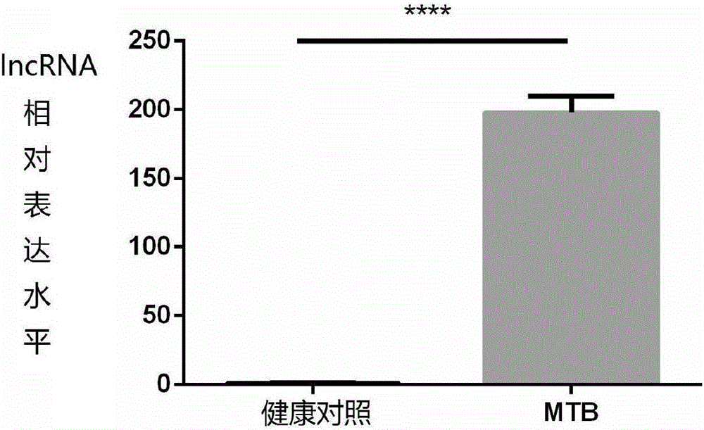 Applications of lncRNA-MIR3945HG V2 in diagnosis of mycobacterium tuberculosis negative pulmonary tuberculosis