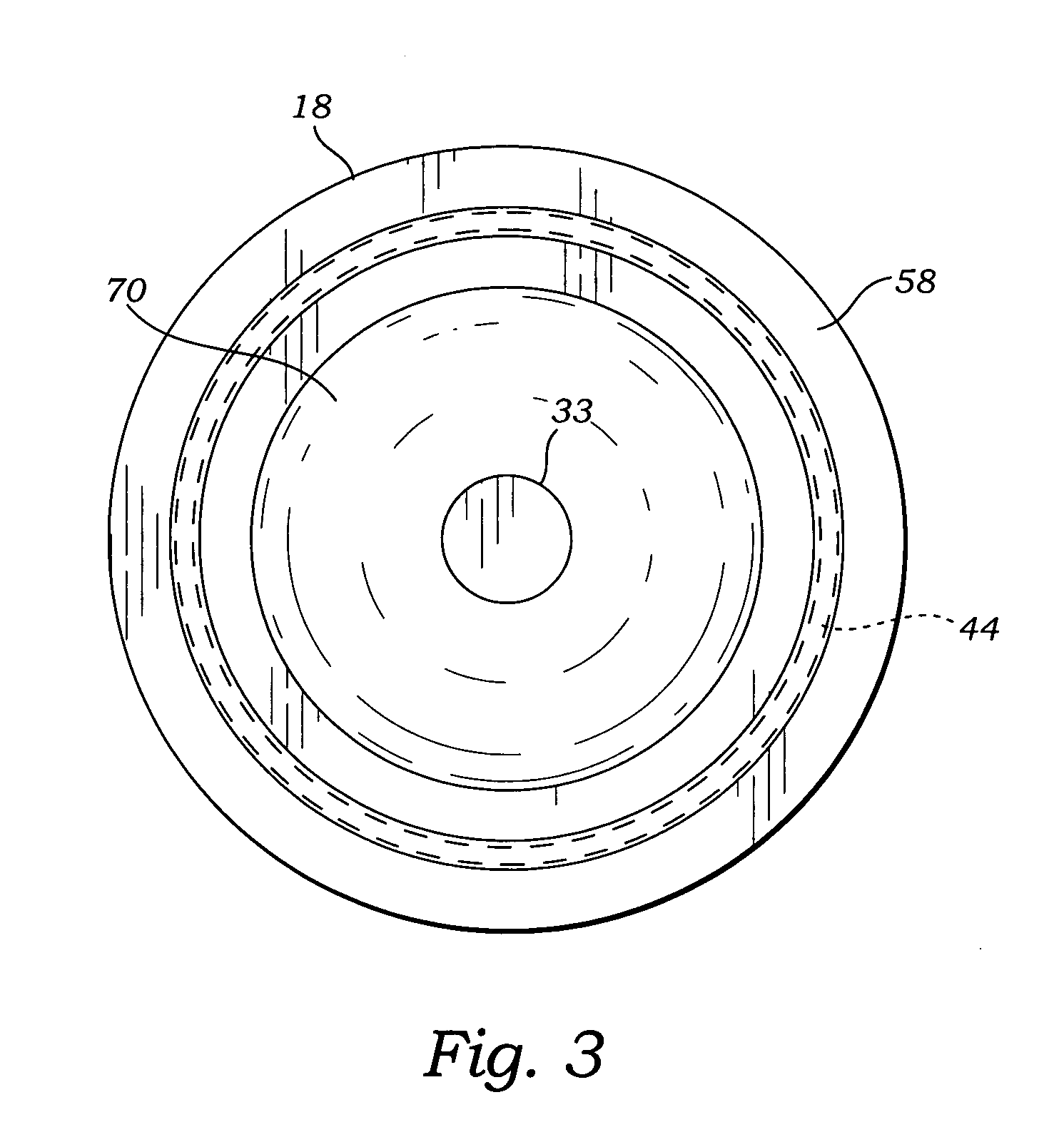 Valve diaphragm with a compression restraining ring, and valve including same