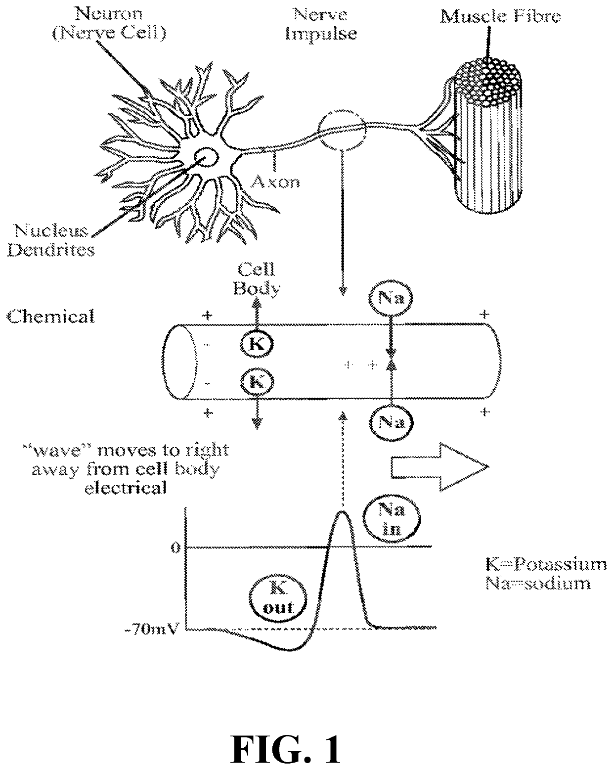 Detection and treatment of obstructive sleep apnea