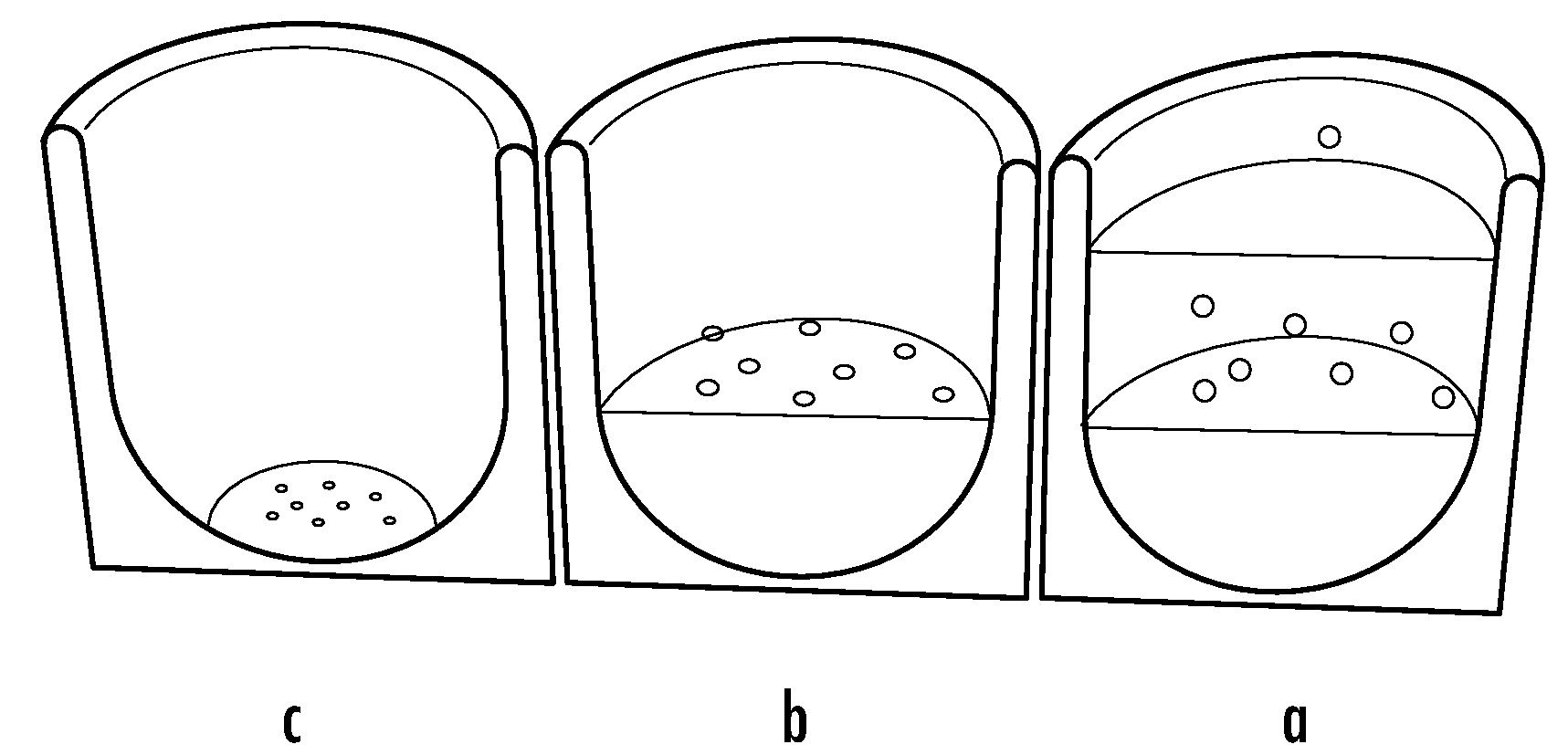 Loadable Polymeric Microparticles for Therapeutic Use in Alopecia and Methods of Preparing and Using the Same