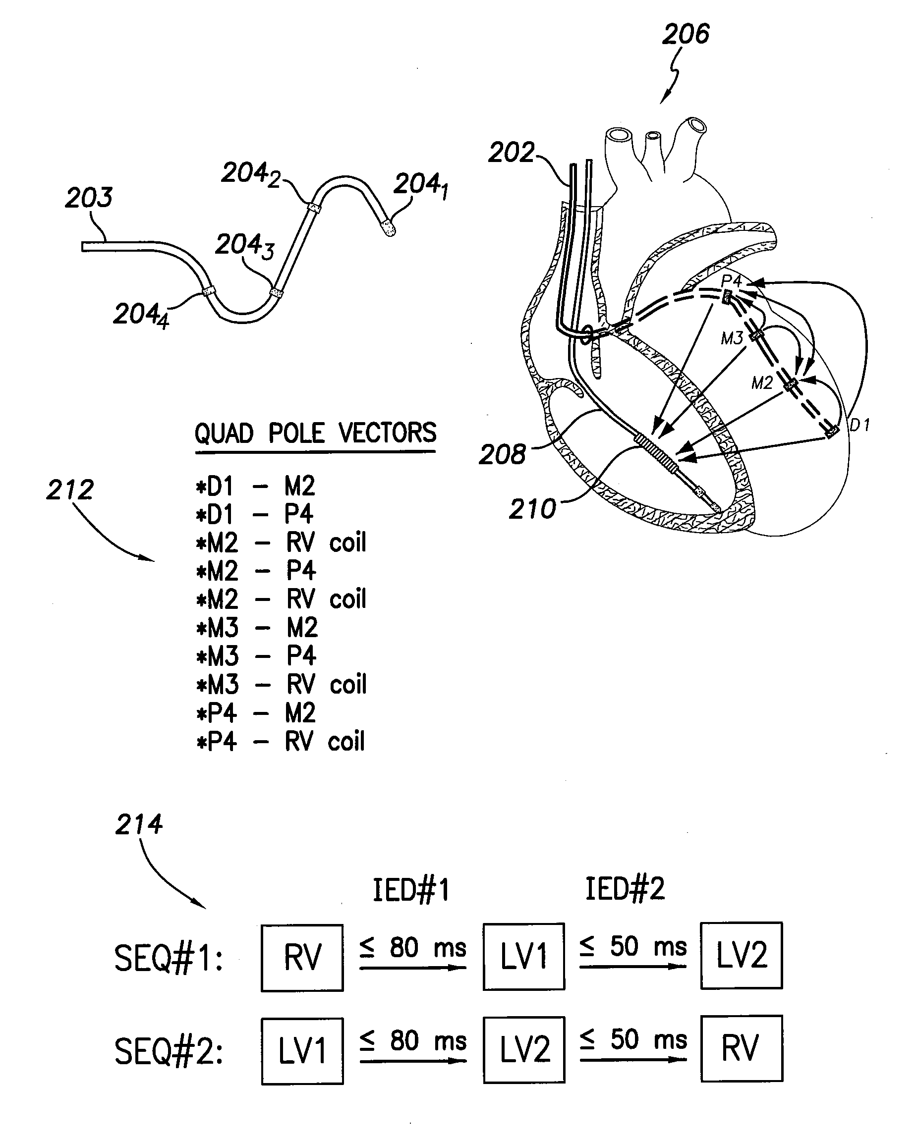 Systems and methods for selectively limiting multi-site ventricular pacing delays during optimization of cardiac resynchronization therapy parameters