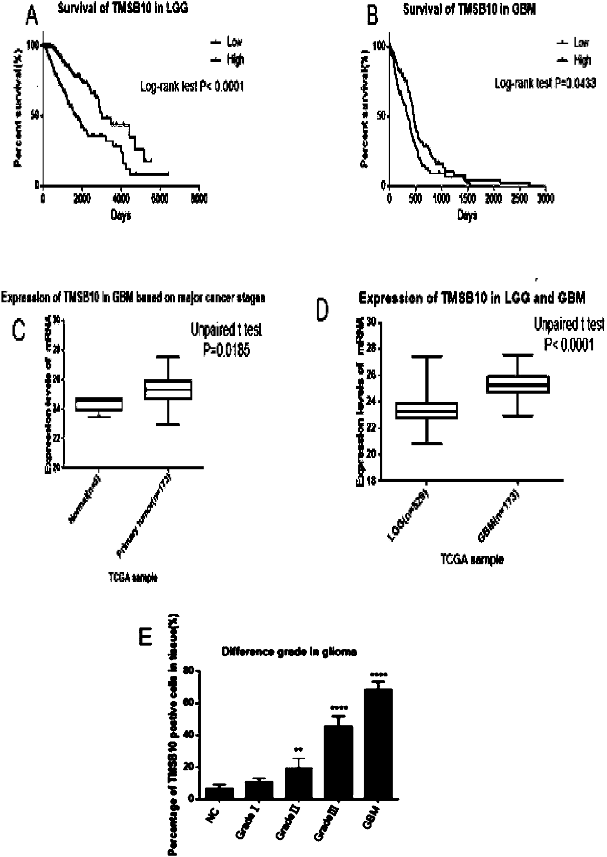 Application of TMSB10 in diagnosis and treatment of glioma