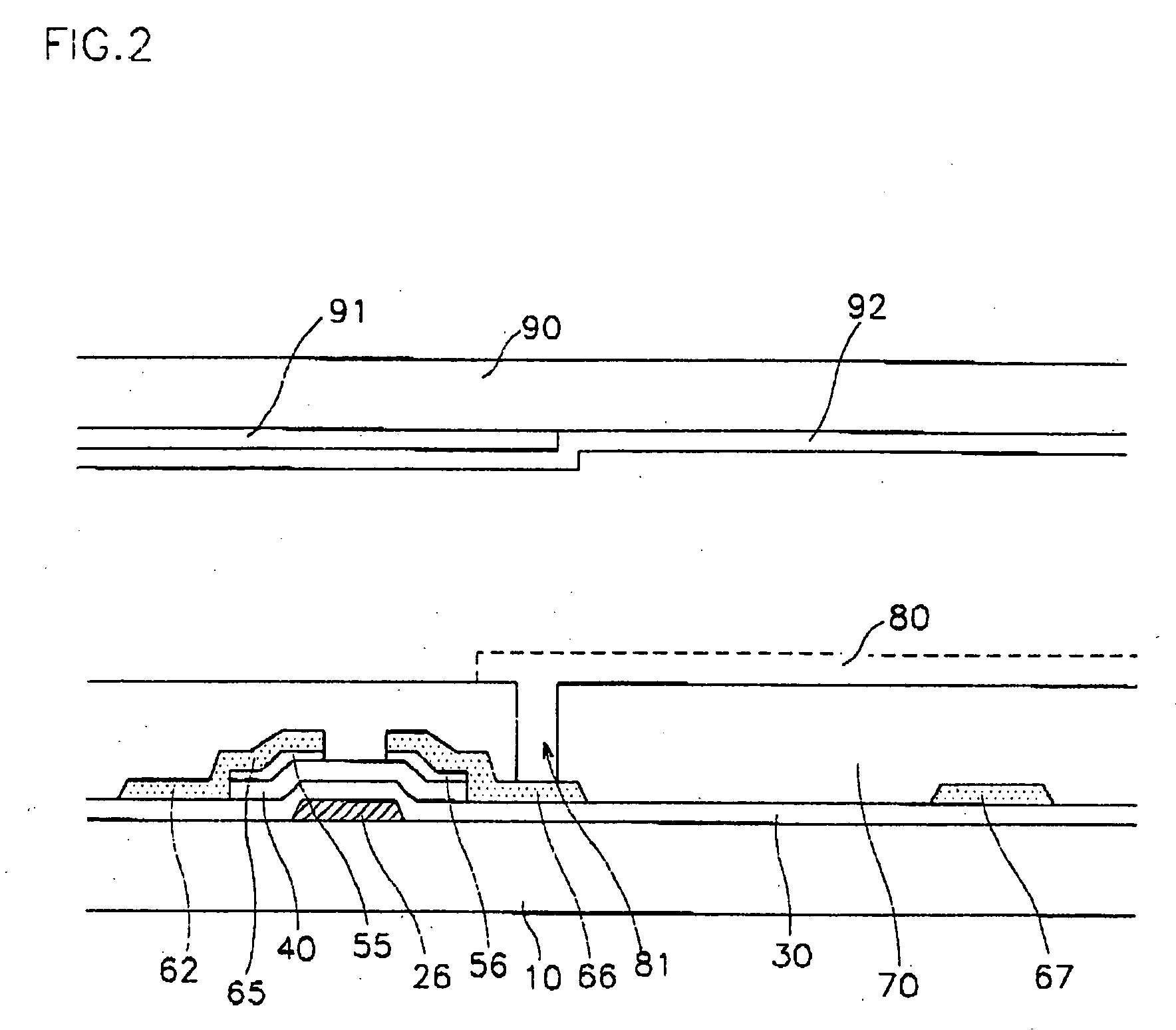 Liquid crystal display