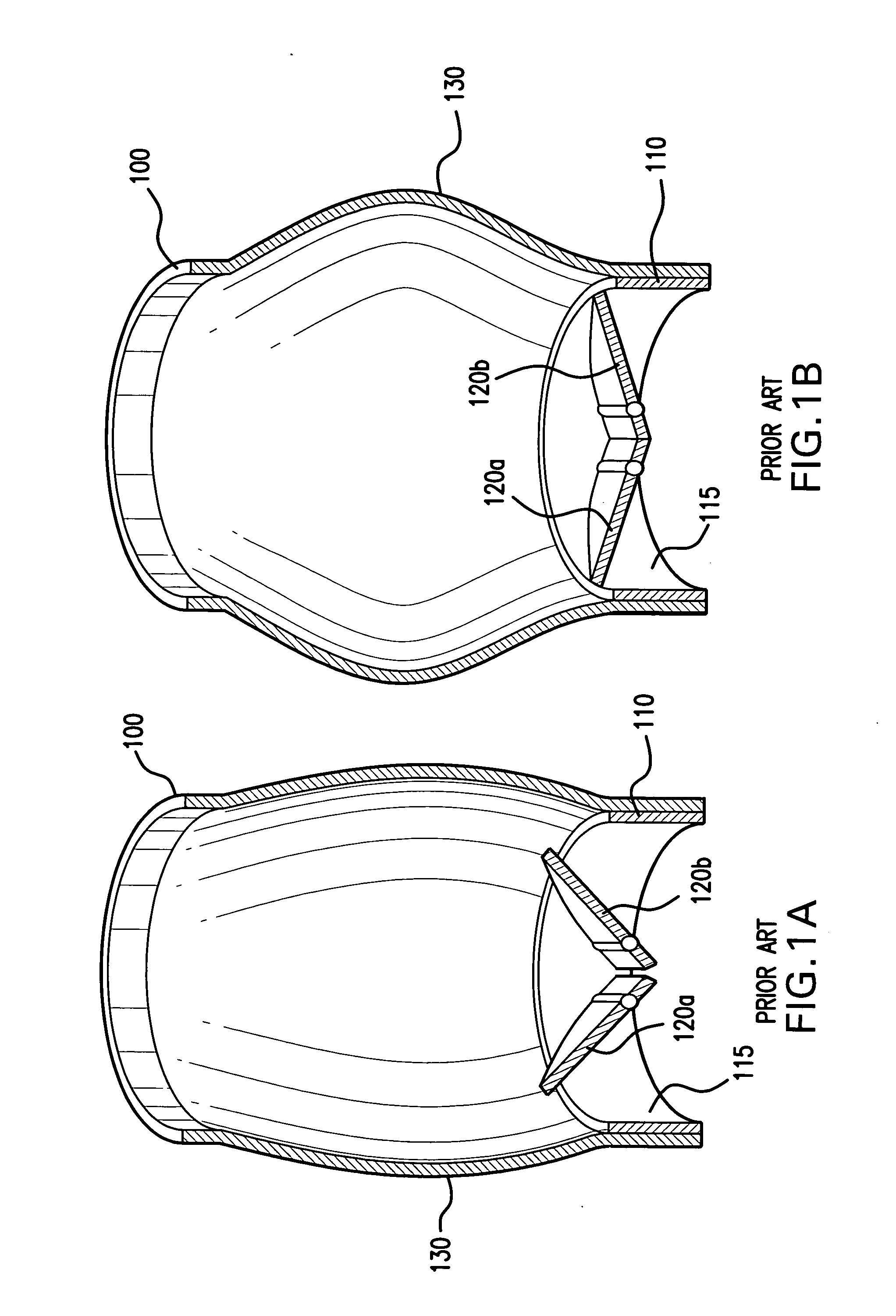 Shock dampening biocompatible valve