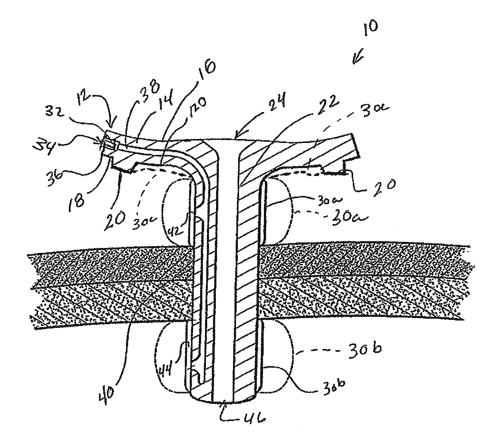 Skin level device for use with gastrostomy tube