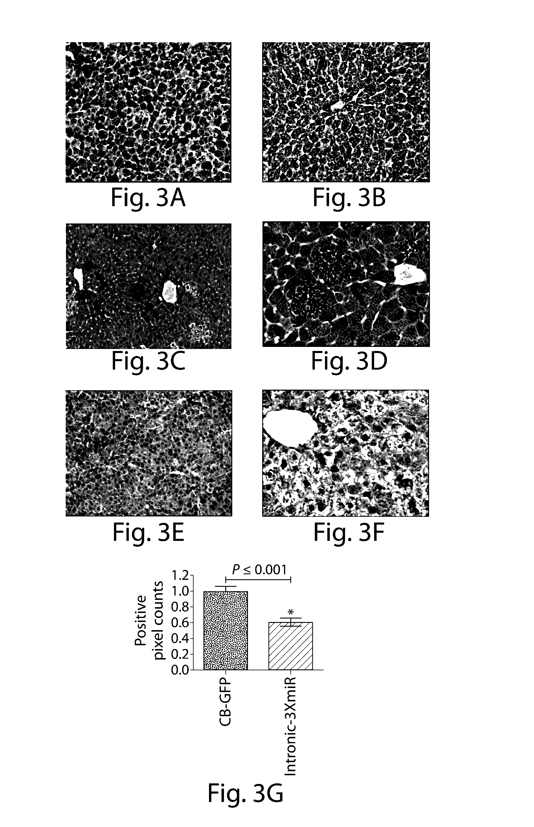 Raav-based compositions and methods for treating alpha-1 Anti-trypsin deficiencies