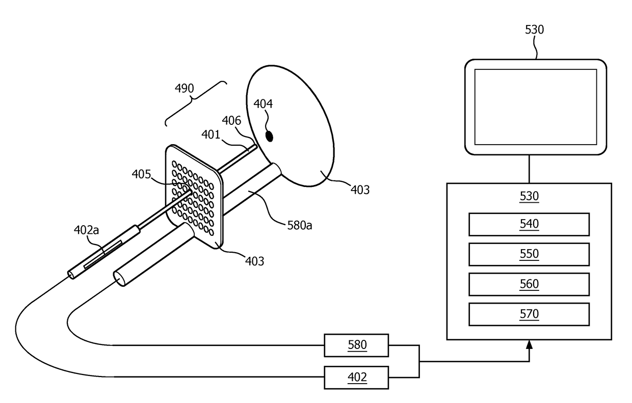 Image guidance system