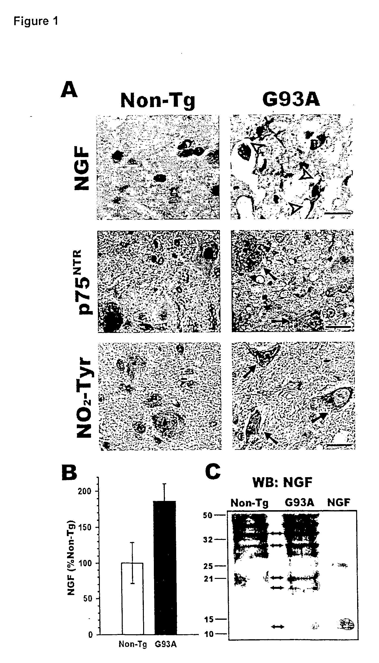 Active or passive immunization against proapoptotic neurotrophins for the treatment and/or prevention of neurodegenerative diseases