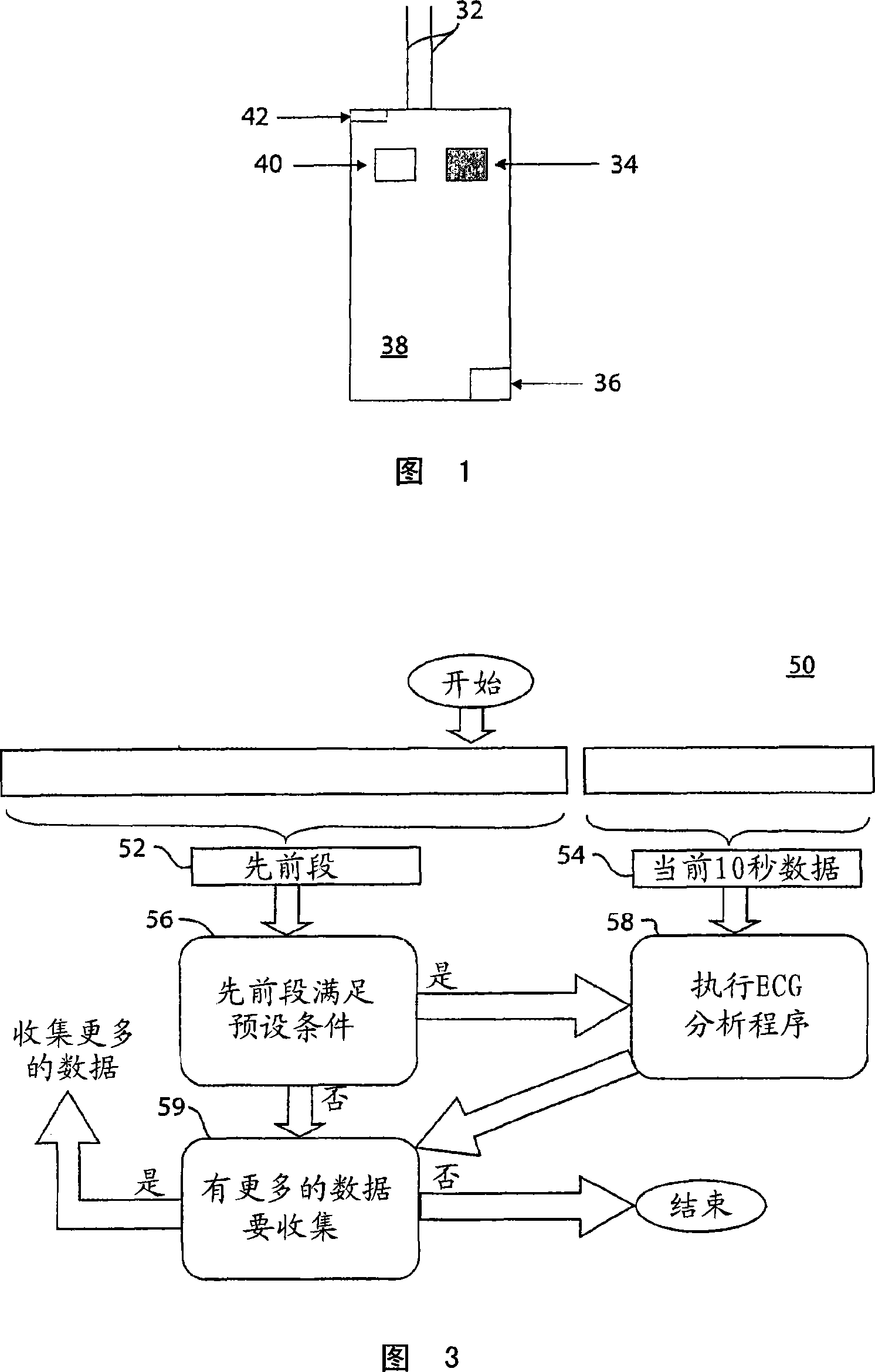 Pre-conditioned ECG system and method