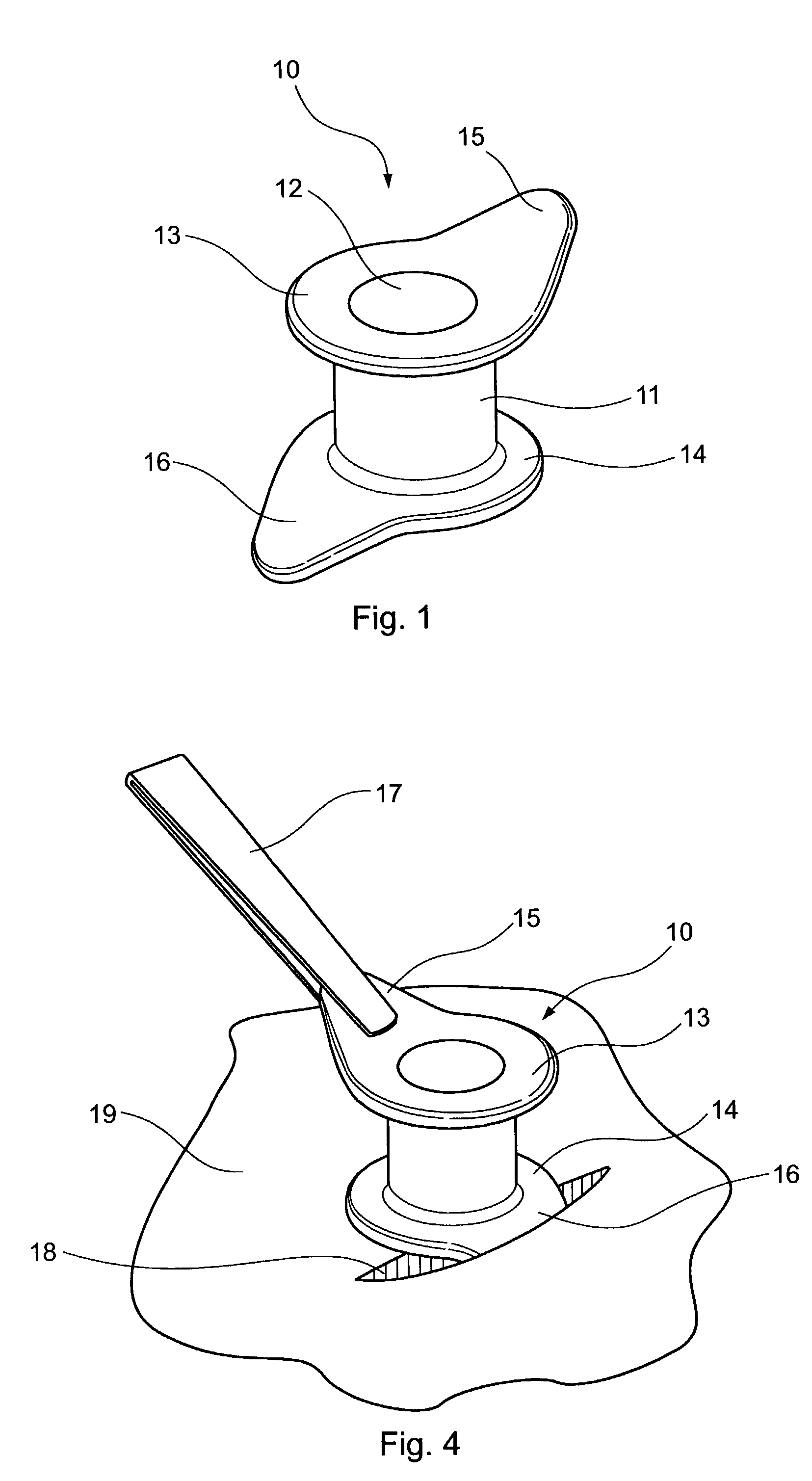 Ventilation tube for a middle ear