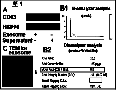 Preparation and application of exosome secreted by human derived blood or mesenchymal stem cell