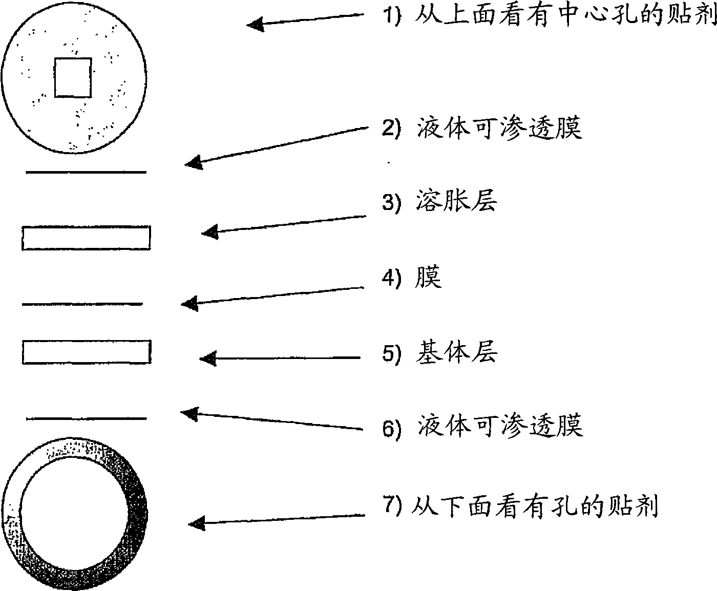 Patch for the expulsion of insect poison from the skin after stings from membranous insects (hymenoptera)