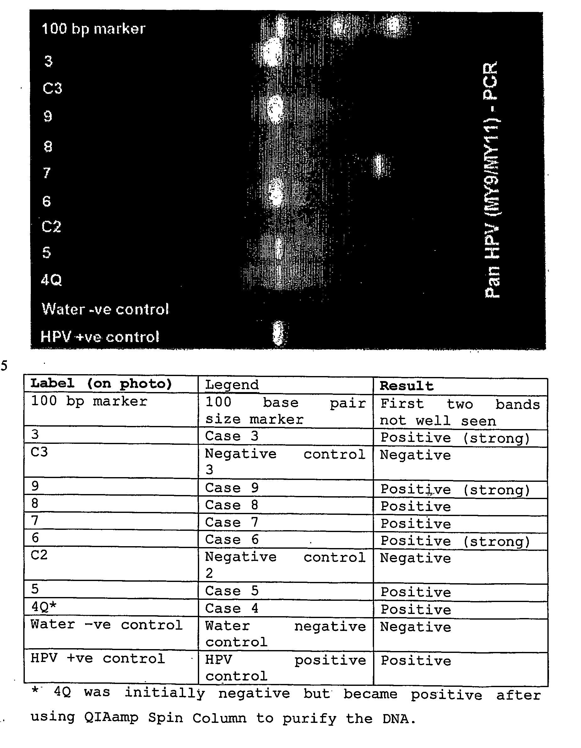 Methods of collecting and transporting vaginal discharge for detection of infectious organisms and to facilitate cervical cancer screening