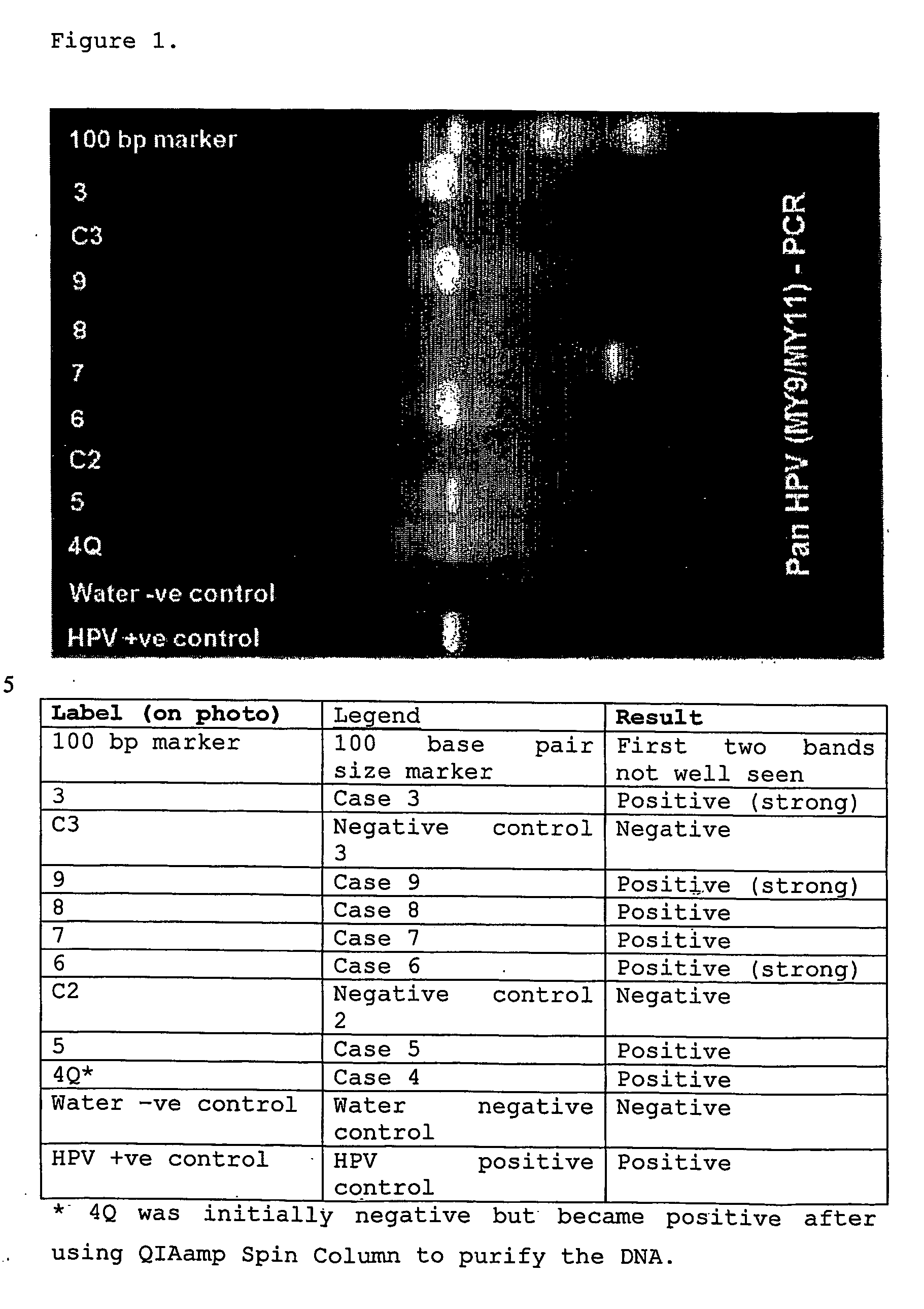 Methods of collecting and transporting vaginal discharge for detection of infectious organisms and to facilitate cervical cancer screening