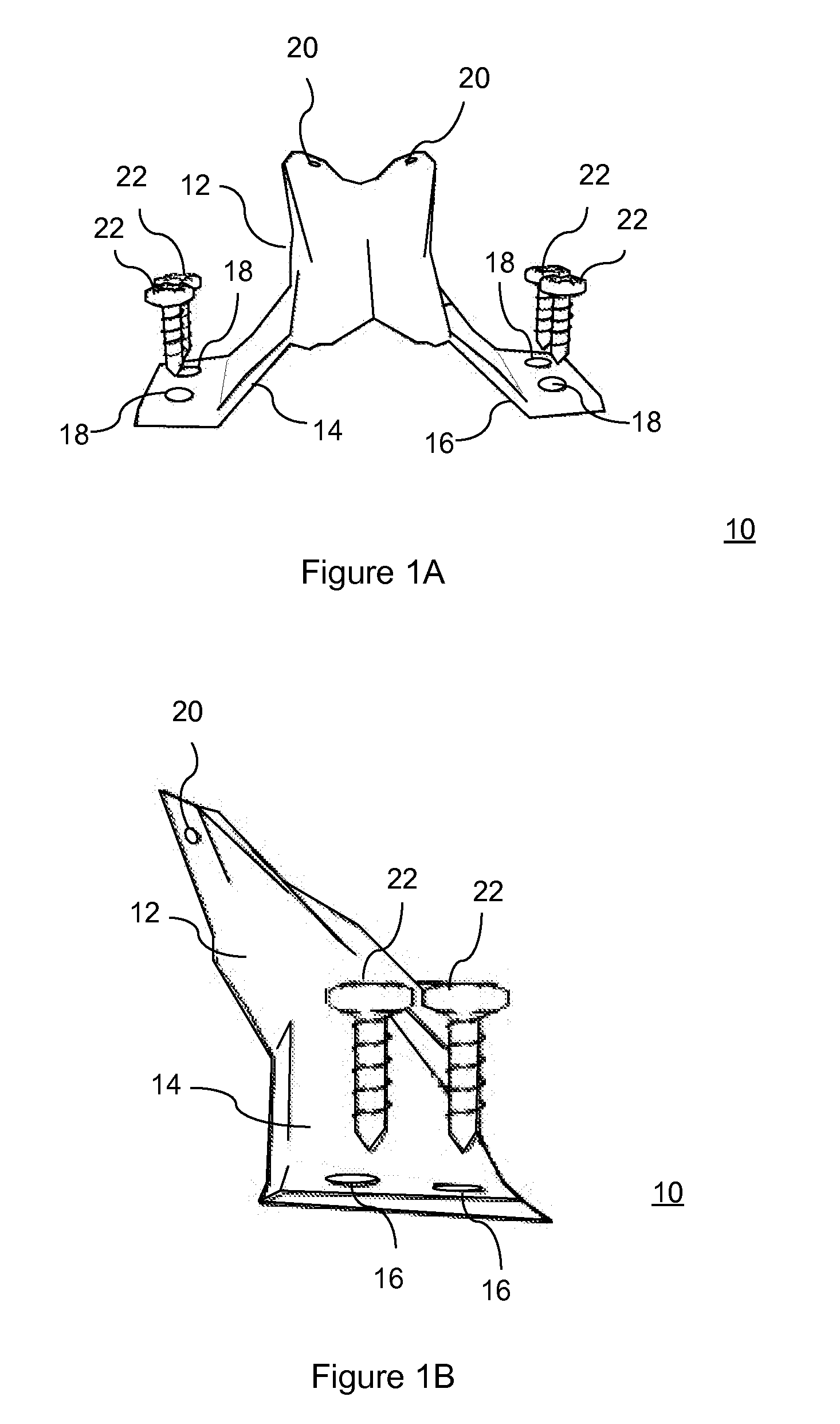 Total artificial spino-laminar prosthetic replacement