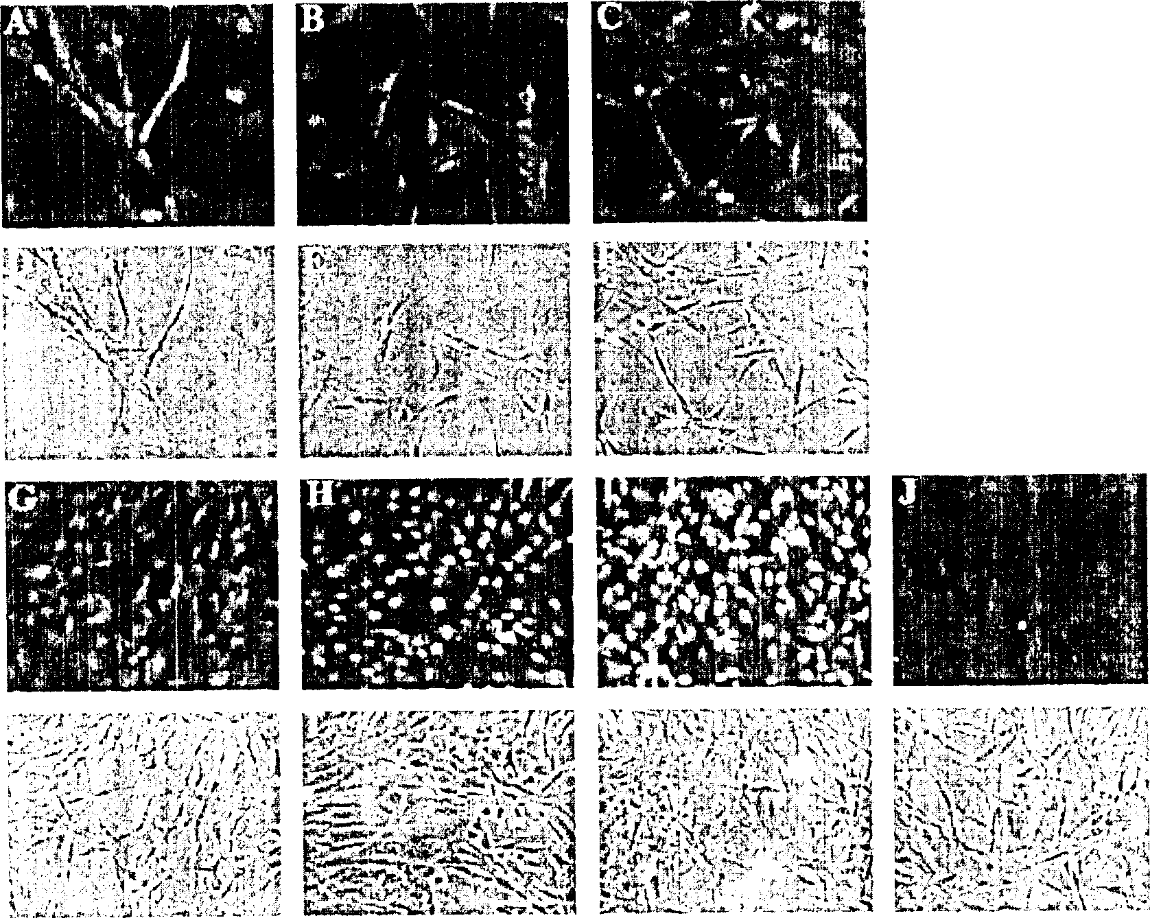 Method of preparing cell for transplantation