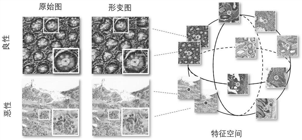 Pathological image analysis method based on deformation representation learning