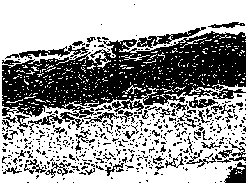 Artificial three-dimensional epidermis model, and construction method and construction medium thereof