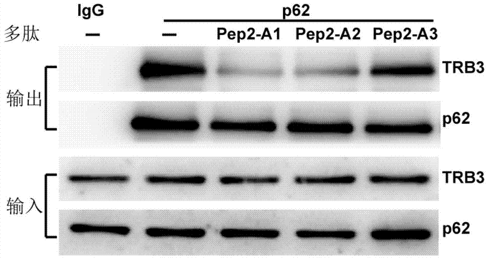 Applications of polypeptide in preparation of drugs for treatment or prevention of diabetic cardiomyopathy