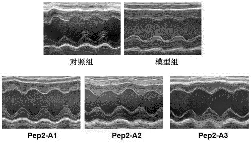 Applications of polypeptide in preparation of drugs for treatment or prevention of diabetic cardiomyopathy