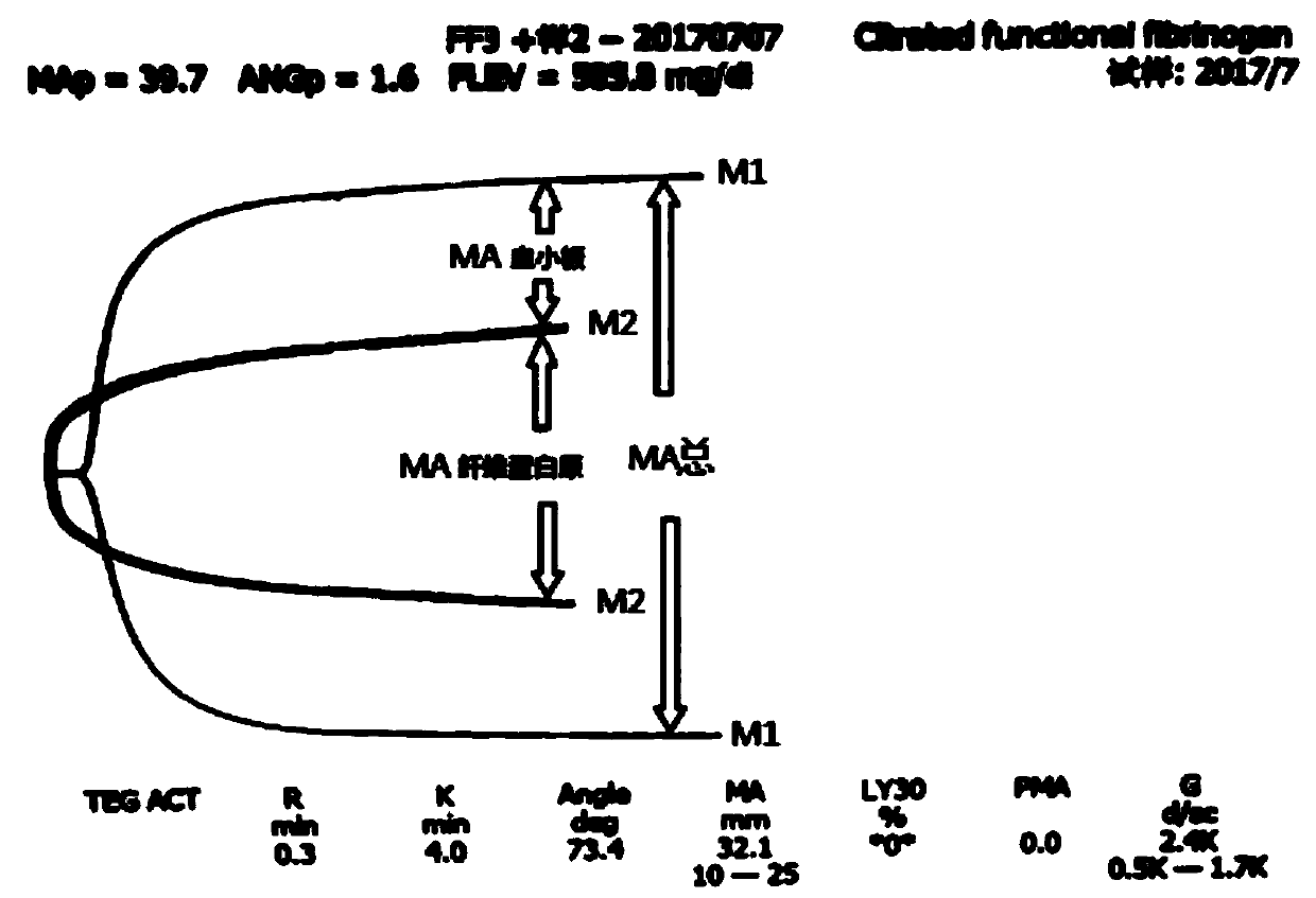 Fibrinogen detection reagent/freeze-dried detection reagent for completely inhibiting function of platelets and preparation method of fibrinogen detection reagent/ freeze-dried detection reagent