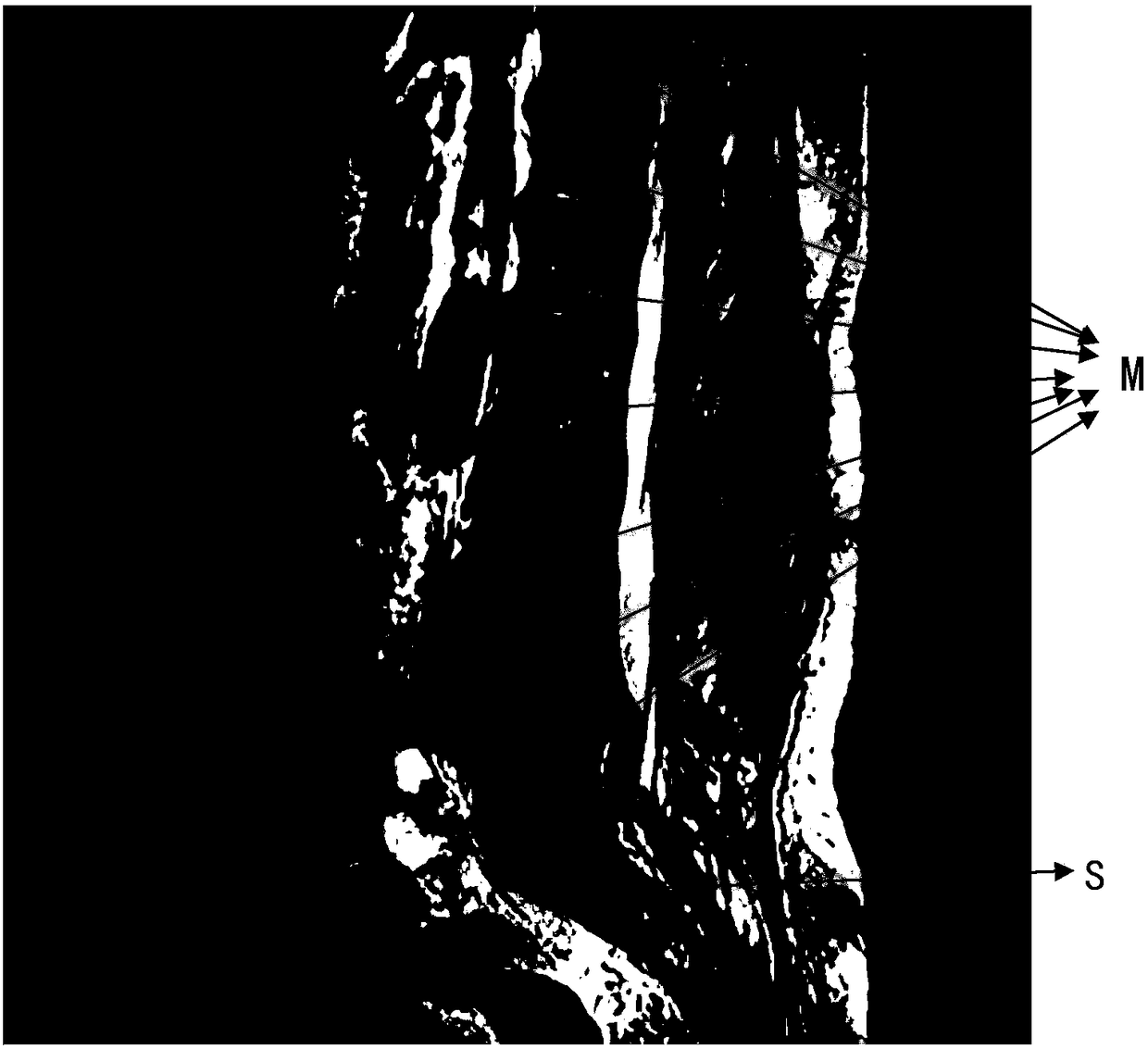 Locating model generation method and spinal sagittal image processing method