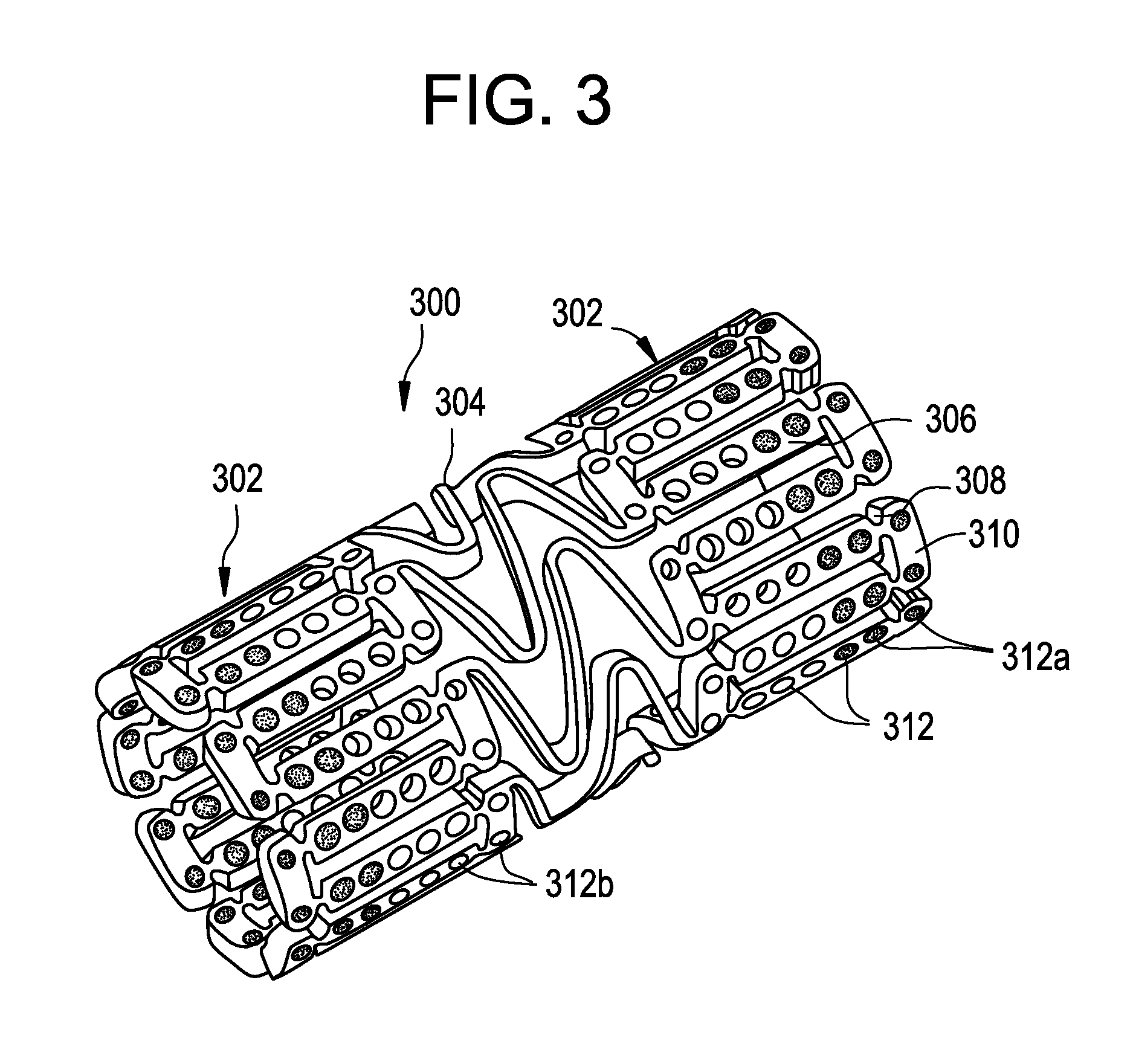 Bare metal stent with drug eluting reservoirs having improved drug retention