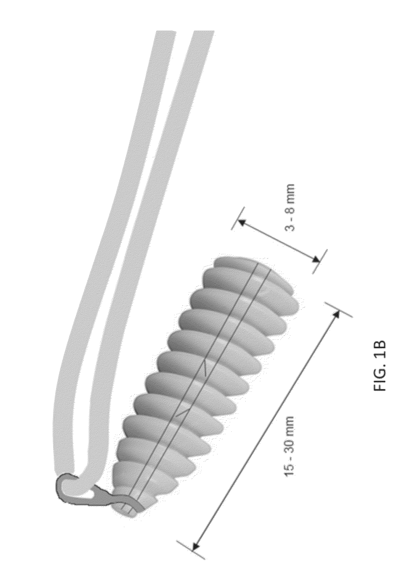 Implant and method for repair of the anterior cruciate ligament