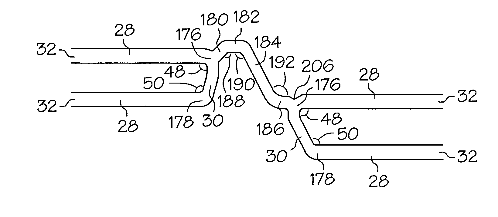 Intravascular stent