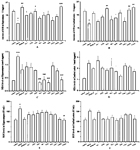 Traditional Chinese medicine composition for treating Alzheimer disease and preparation method of composition