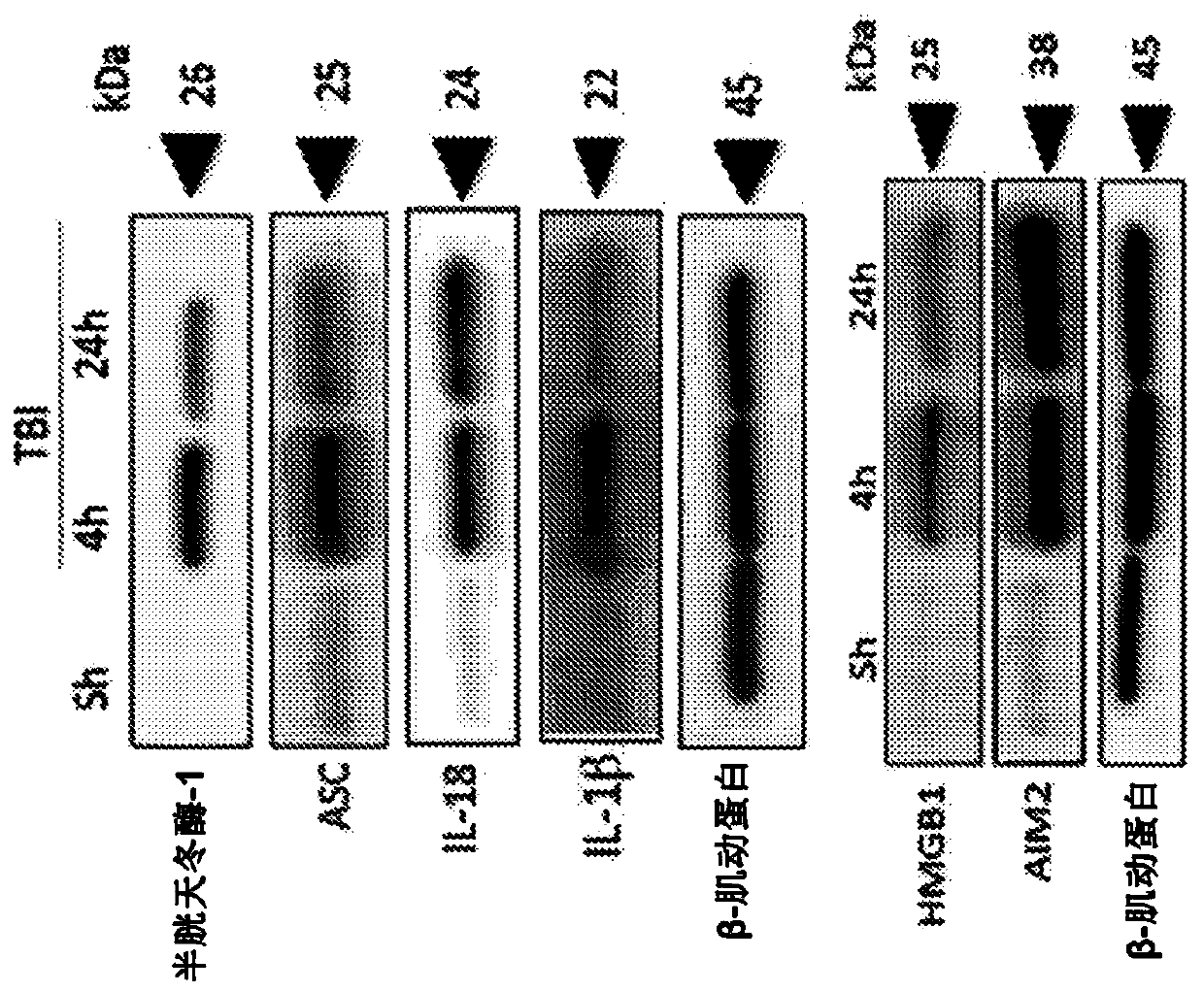 Method for modulating inflammasome activity and inflammation in the lung