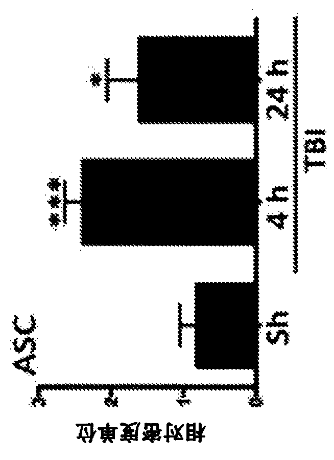 Method for modulating inflammasome activity and inflammation in the lung