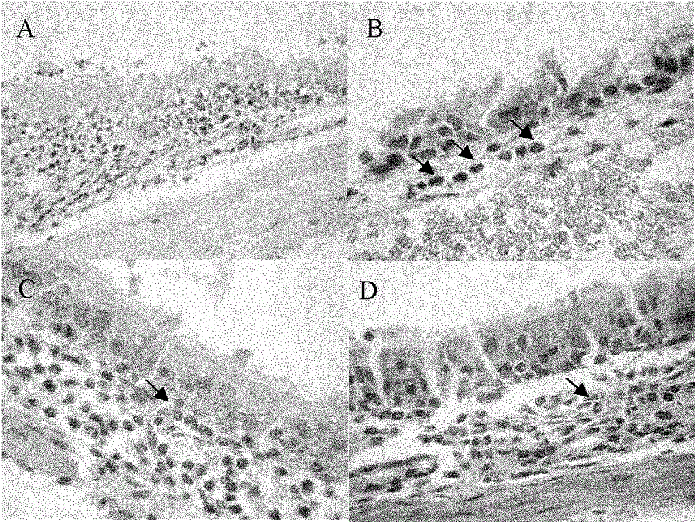 Application of IL-1ra-Fcepsilon fusion gene and coded protein thereof to treatment on allergic rhinitis