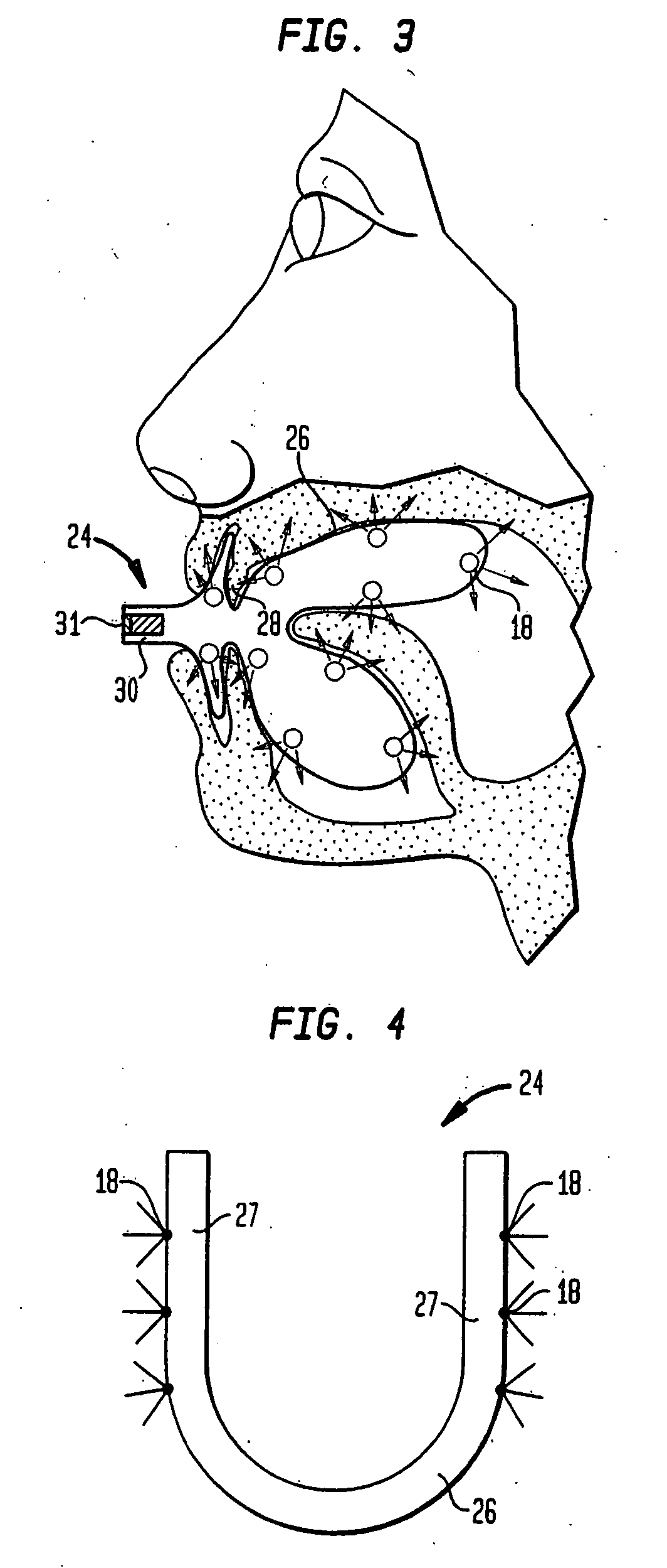 Oral appliance with heat transfer mechanism