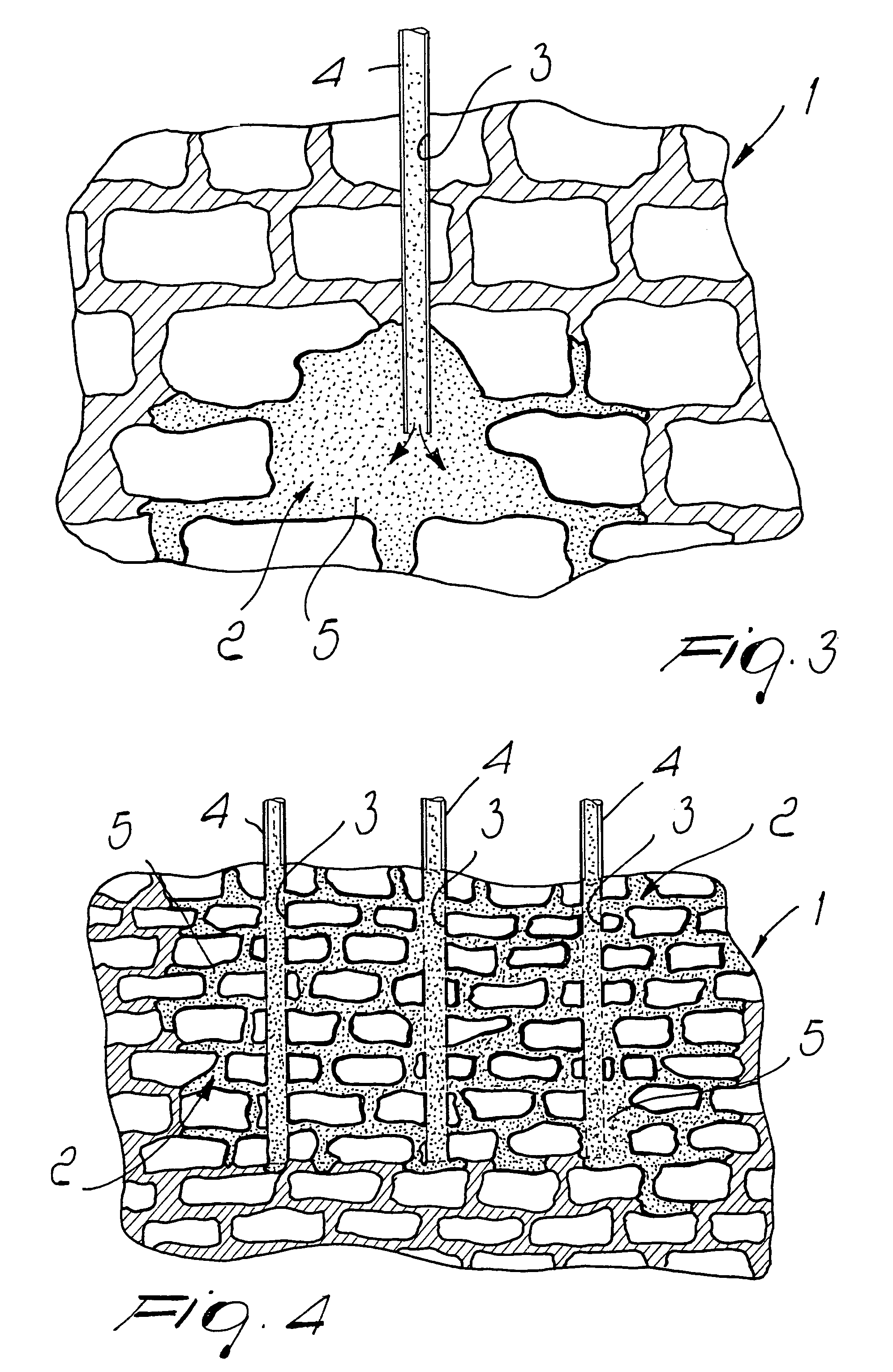 Method for repairing, waterproofing, insulating, reinforcing, restoring of wall systems