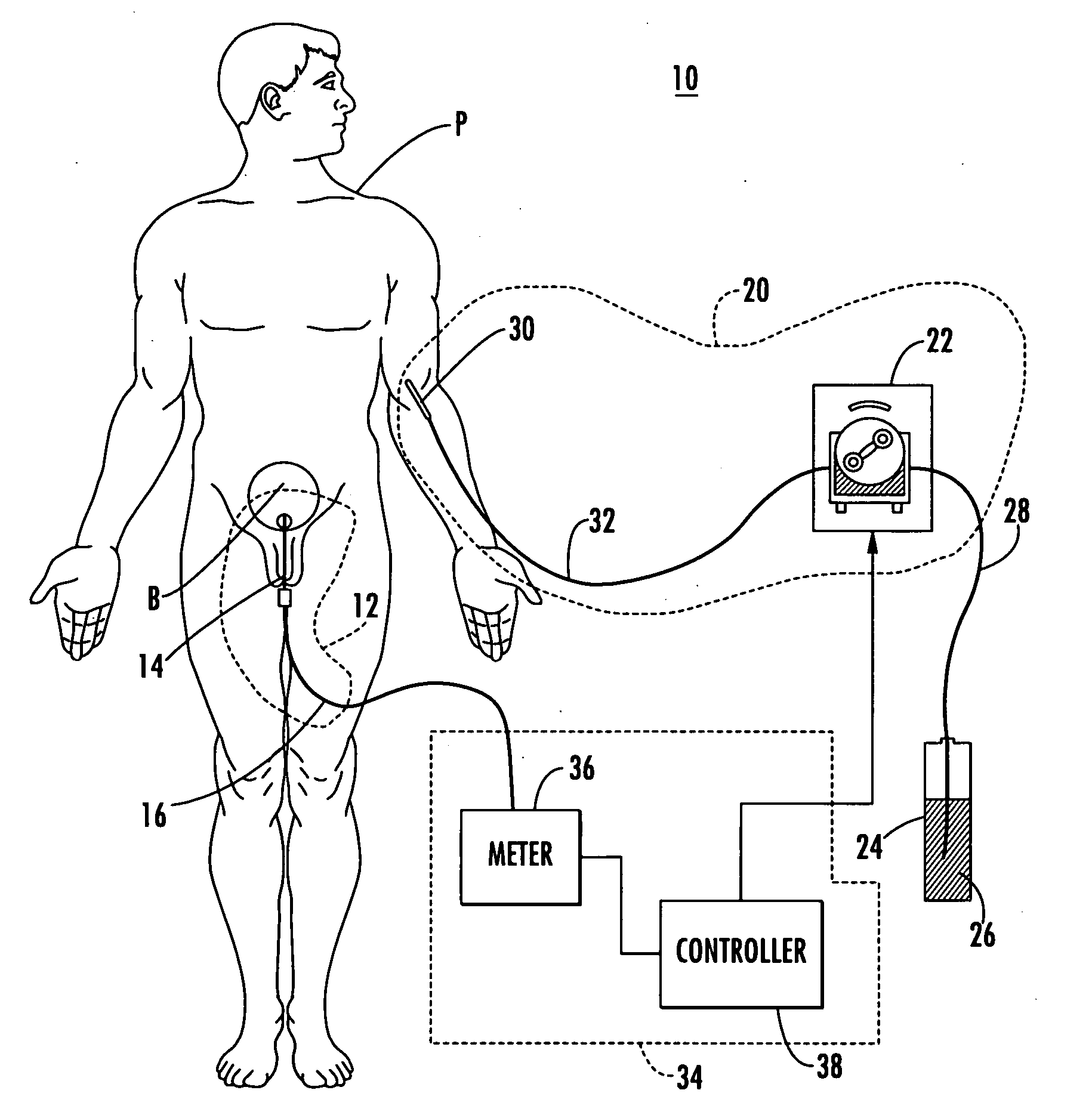 Patient hydration system with abnormal condition sensing