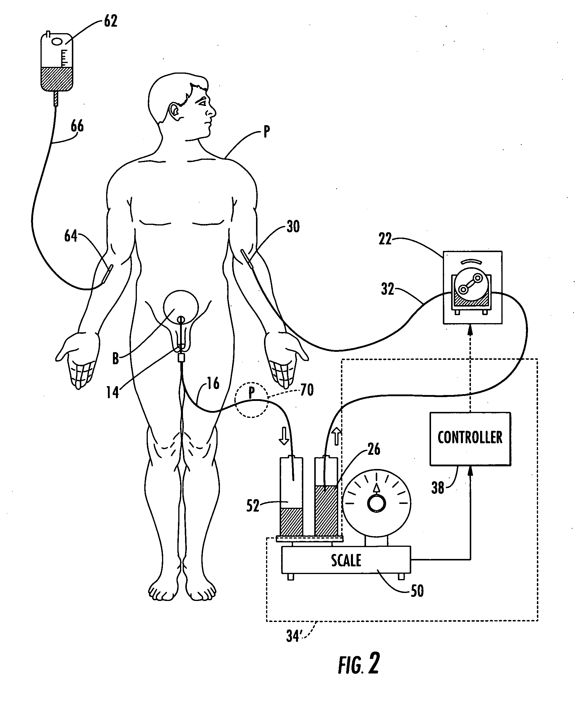 Patient hydration system with abnormal condition sensing