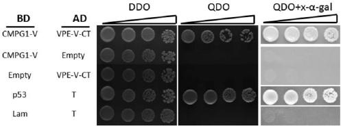 Haynaldia villosa vacuolar processing enzyme gene VPE3-V and its silencing vector and application thereof