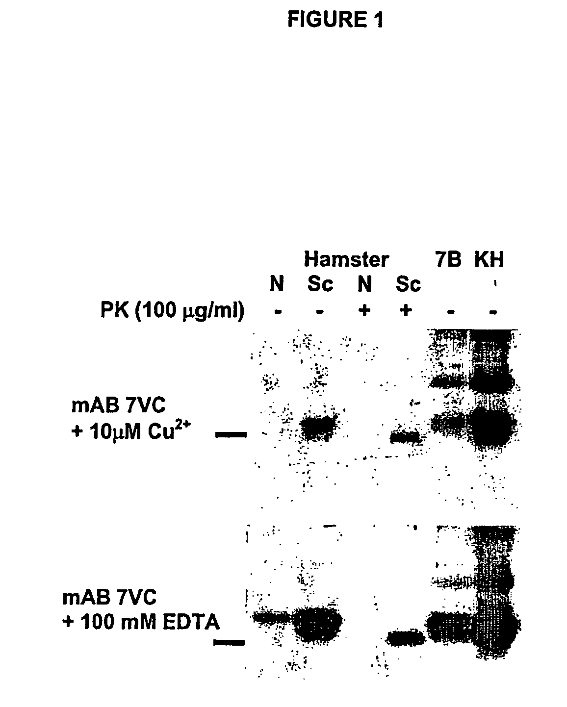 Use of monoclonal antibodies to distinguish protein conformational isoforms