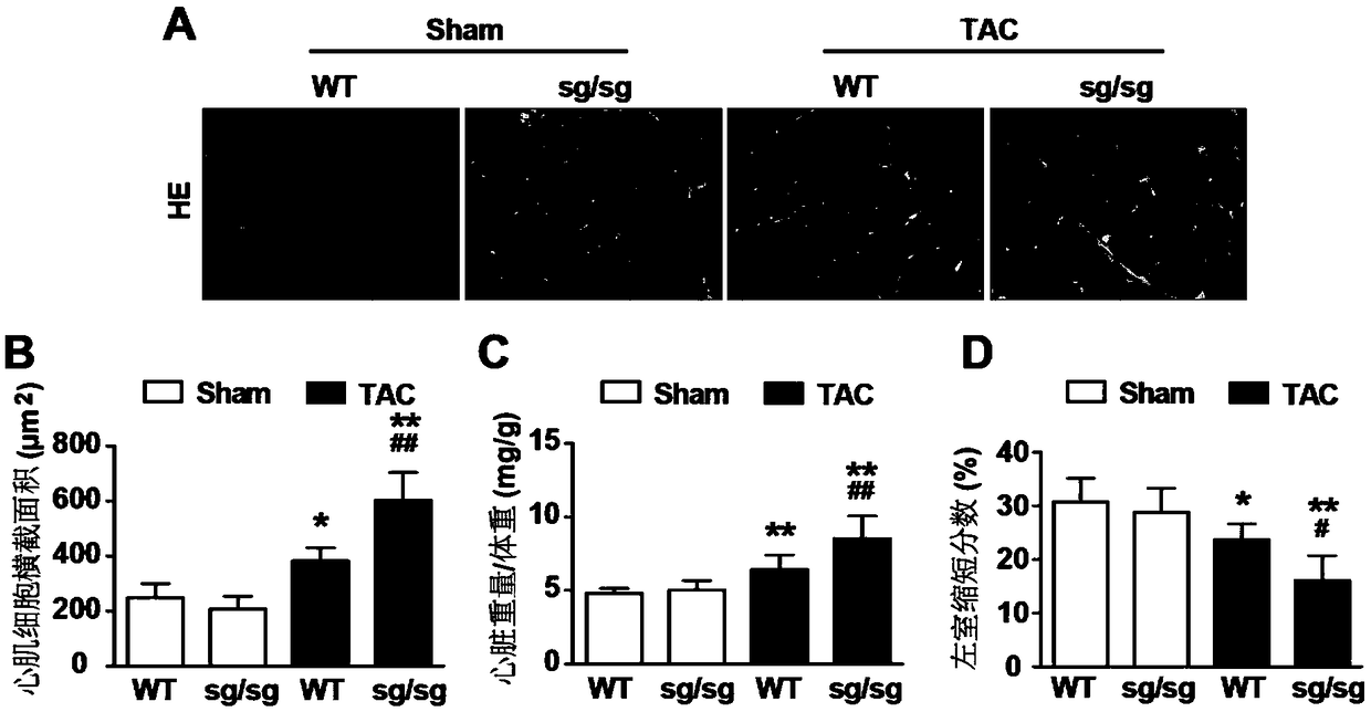 Application of nuclear receptor ROR alpha in preparation of anti-heart failure drugs