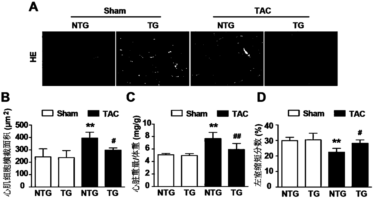 Application of nuclear receptor ROR alpha in preparation of anti-heart failure drugs