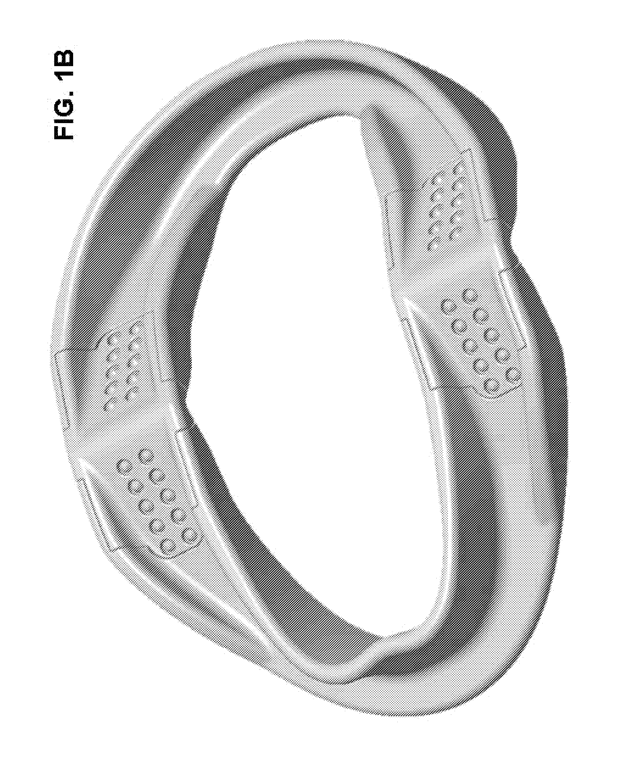 Incremental and/or successive adjustable mandibular advancement device for preventing and treatment of snoring and obstructive sleep apnea