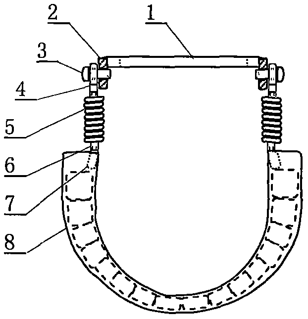 Non-invasive external stent for preventing tongue root suffix during sleep